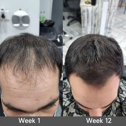 🇺🇸 Official U.S. Store | PURELORA® 2-in-1 Onion & Rosemary Shampoo + Conditioner 🌿 | 15X Active Complex for Fuller, Thicker-Looking & Stronger Hair