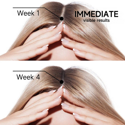 🇺🇸 Official U.S. Store | PURELORA® 2-in-1 Onion & Rosemary Shampoo + Conditioner 🌿 | 15X Active Complex for Fuller, Thicker-Looking & Stronger Hair