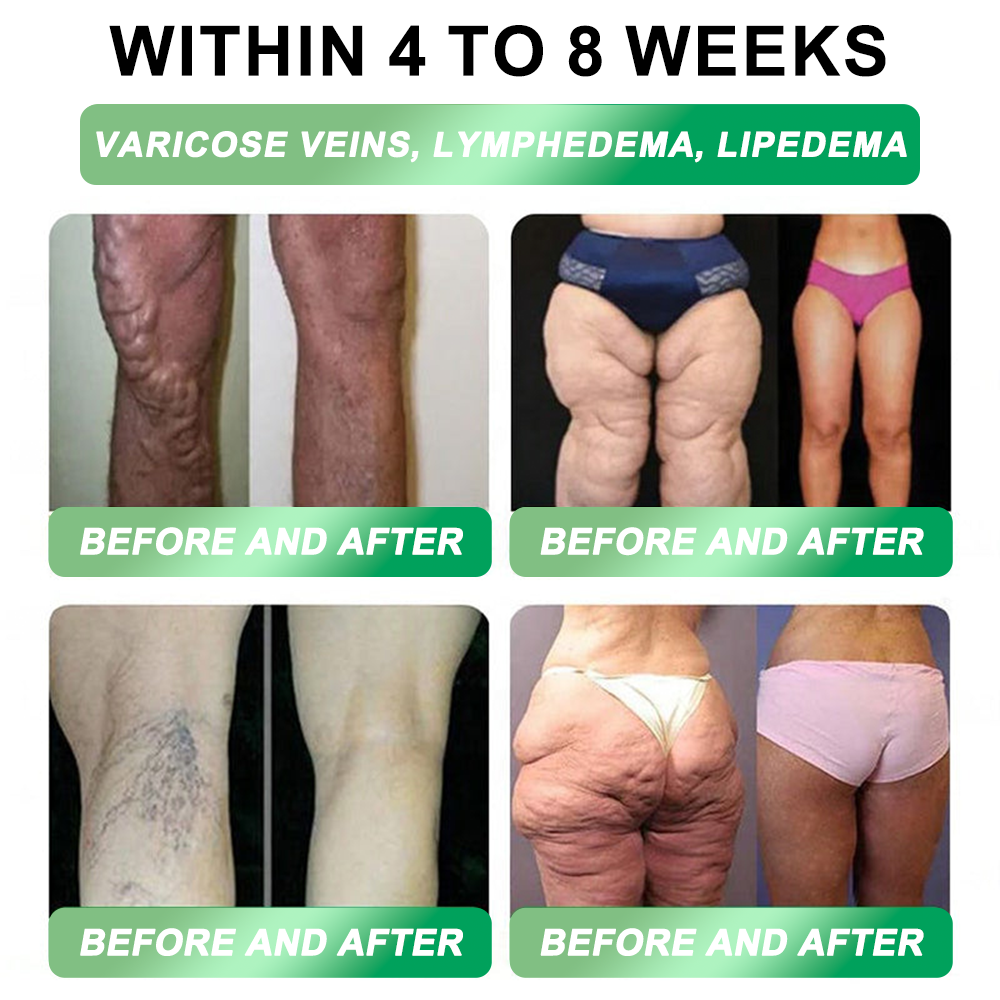 💖New Release 🎉 — Enjoy 80% OFF Today | 🇺🇸 Purelora® Moringa · Berberine × NAD+ 10-in-1 Liposomal Cryo-Gel Nano Microneedle Firming Patch ✅ Advanced Cryo-Metabolic Support: Freeze Fat, Firm Skin, & Flush Edema Instantly.