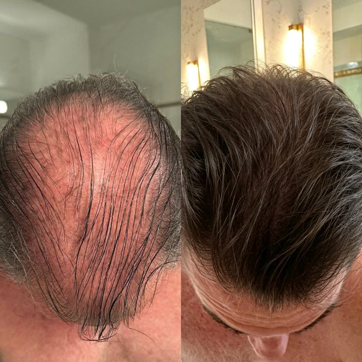 🇺🇸 Official U.S. Store | PURELORA® 2-in-1 Onion & Rosemary Shampoo + Conditioner 🌿 | 15X Active Complex for Fuller, Thicker-Looking & Stronger Hair