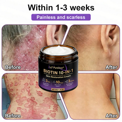 Made and Shipped from the USA 🍁 Purelora® Biotin 10-in-1 Skin Repair Cream — Last Day of Sale: 75% Off