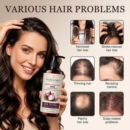 🇺🇸 Official U.S. Store | PURELORA® 2-in-1 Onion & Rosemary Shampoo + Conditioner 🌿 | 15X Active Complex for Fuller, Thicker-Looking & Stronger Hair