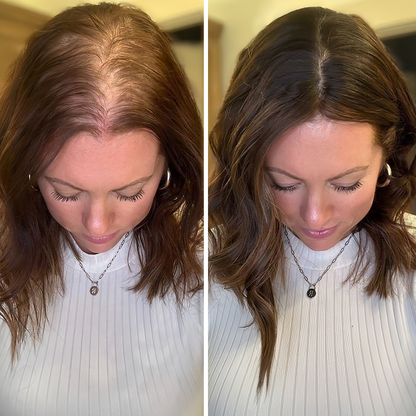 🇺🇸 Official U.S. Store | PURELORA® 2-in-1 Onion & Rosemary Shampoo + Conditioner 🌿 | 15X Active Complex for Fuller, Thicker-Looking & Stronger Hair